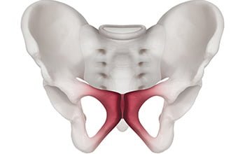 Osteit Pubis