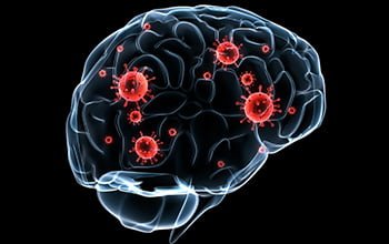 Mərkəzi Sinir Sisteminin İnfeksiyaları